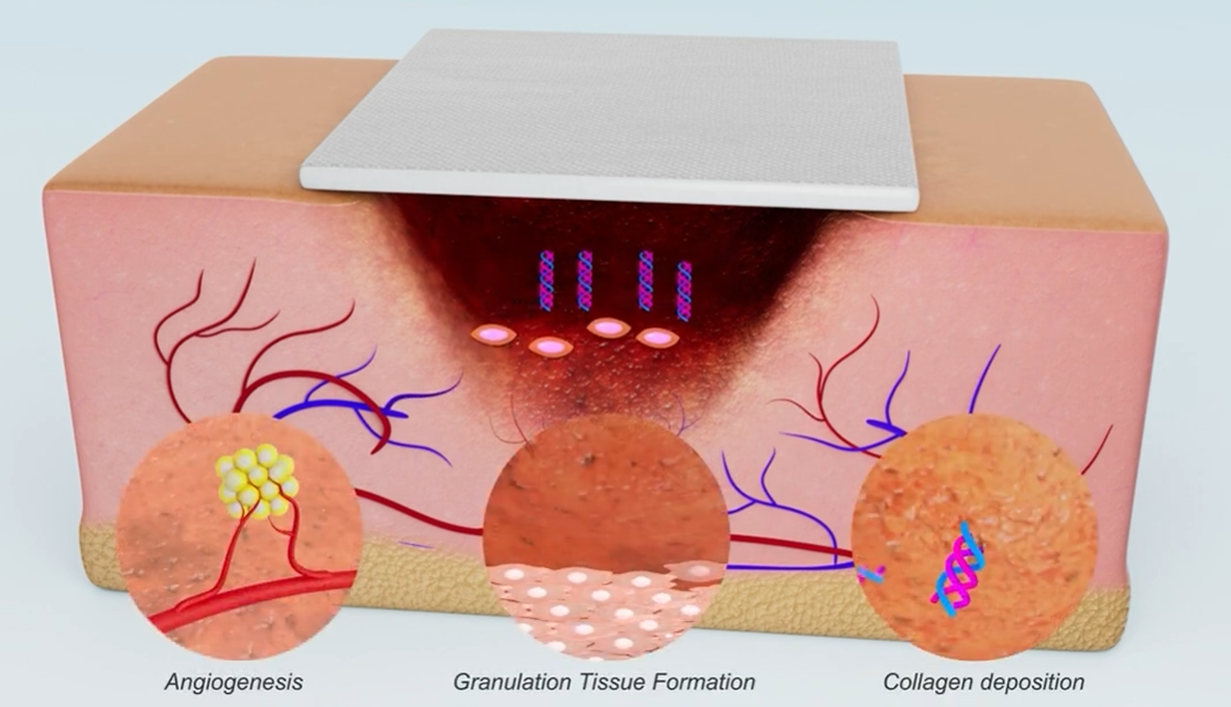 3d medical animation studio in India sample